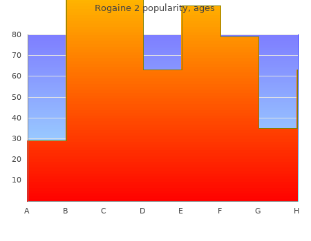 60  ml rogaine 2 for sale